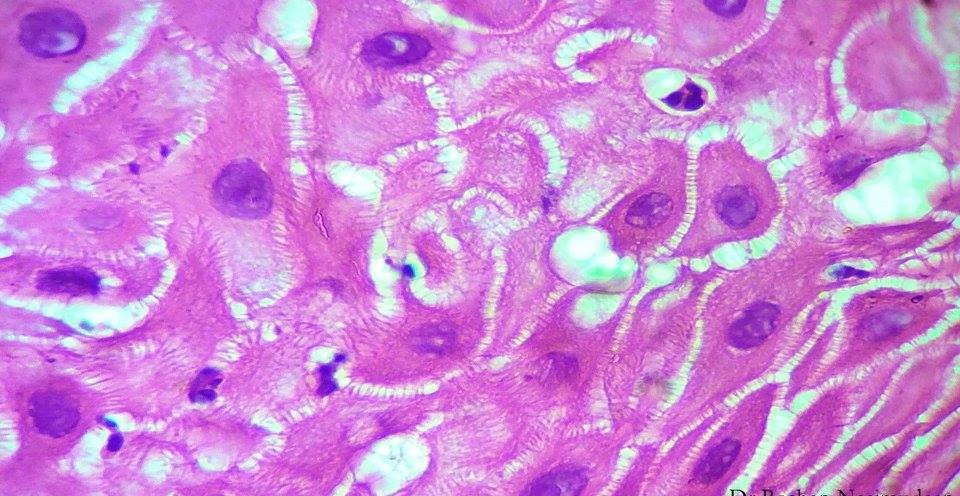 keratinocytes